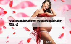 婴儿肚脐出血怎么护理（婴儿肚脐出血怎么护理图片）