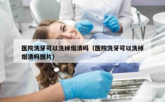 医院洗牙可以洗掉烟渍吗（医院洗牙可以洗掉烟渍吗图片）