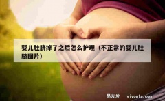 婴儿肚脐掉了之后怎么护理（不正常的婴儿肚脐图片）