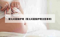 婴儿红屁股护理（婴儿红屁股护理注意事项）