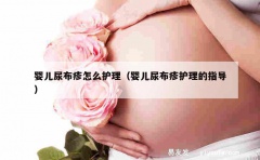 婴儿尿布疹怎么护理（婴儿尿布疹护理的指导）