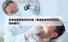 普通金属烤瓷牙的价格（普通金属烤瓷牙的价格和图片）